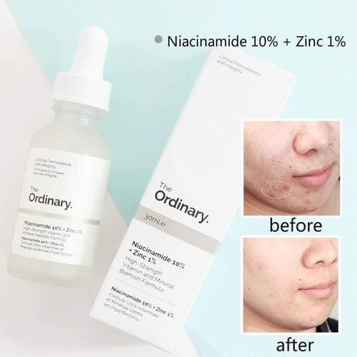 Niacinamide Skin Brightening Serum